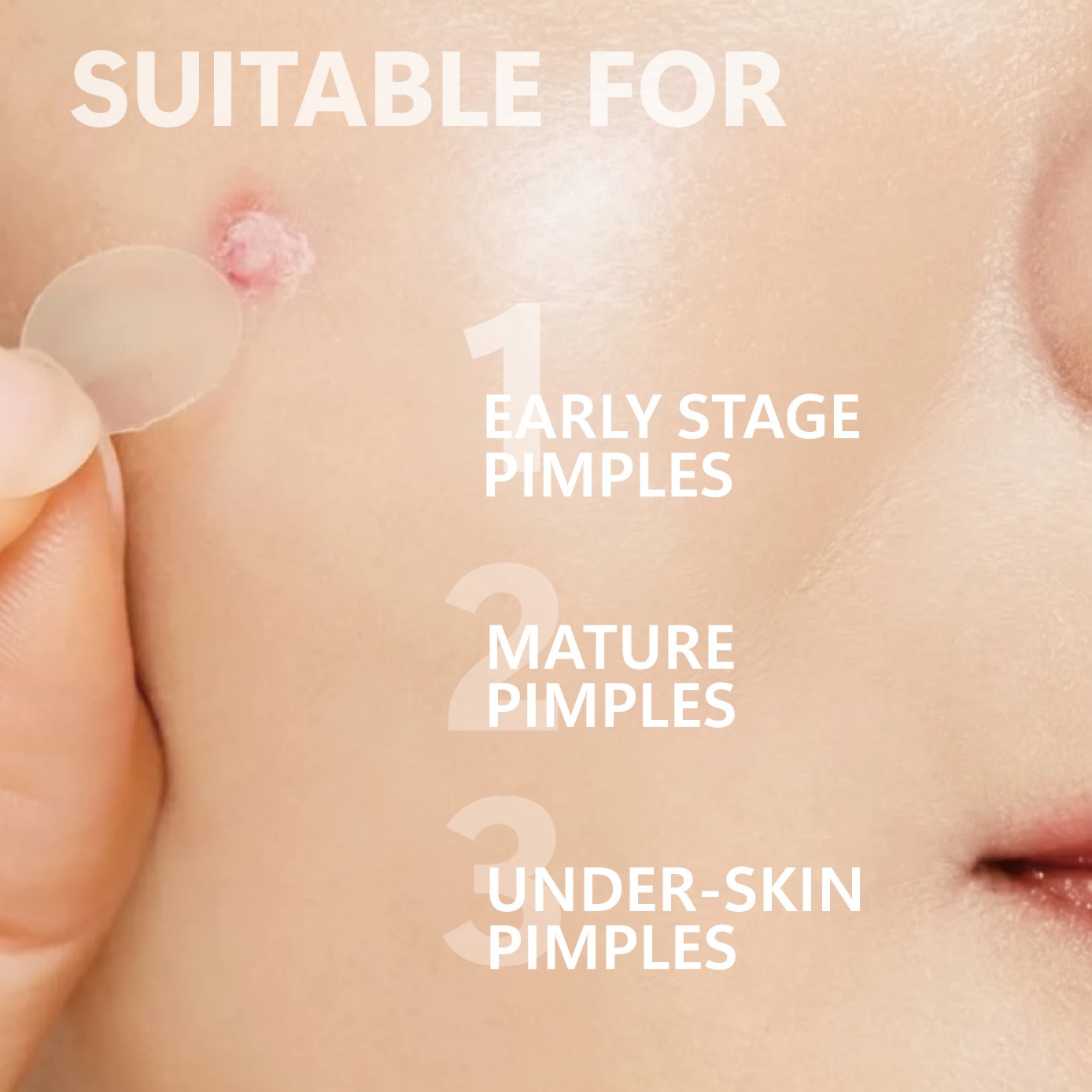 Micro Needle Pimple Patch (24  - Hydrocolloid Pimple Patch review and price