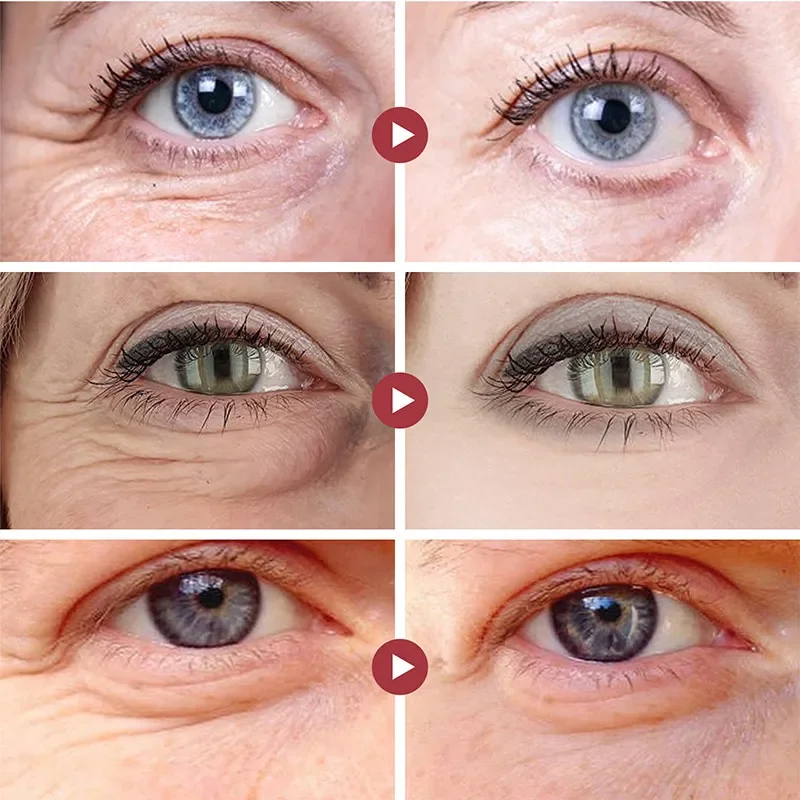Wrinkle Remove Eyes Patches Fi - Collagen Under Eye Patches review and price